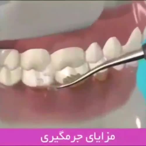ویدئو های دندان پزشکی